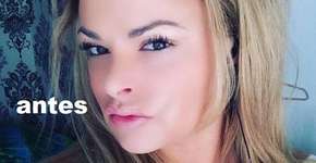 Foto: (Imagem sem texto alternativo disponivel ID [1050496])