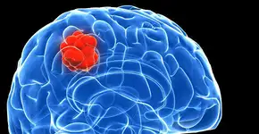 Foto: (Imagem sem texto alternativo disponivel ID [1833425])