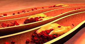 Fruta muito popular reduz o colesterol e ajuda a prevenir câncer