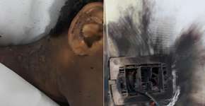 Menina vai parar na UTI após ser atingida por raio dentro de casa