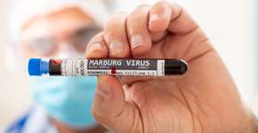 Foto: (Depositphotos/membio)