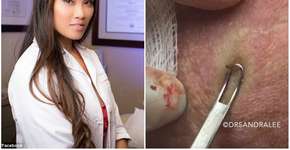 Foto: (Imagem sem texto alternativo disponivel ID [1048621])