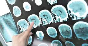 Foto: (Getty Images/iStockphoto)