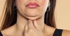 7 maneiras eficazes de acabar com a papada (ou queixo duplo)