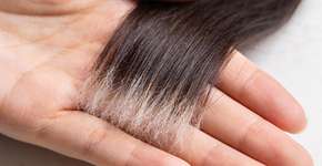 Foto: (Imagem sem texto alternativo disponivel ID [2701474])