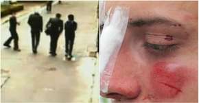 Grupo que agrediu gay na Paulista com lâmpada deverá pagar multa