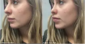 Aplicativos gratuitos simulam efeitos de cirurgia plástica