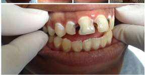 Foto: (Imagem sem texto alternativo disponivel ID [1835907])