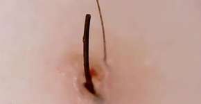 Foto: (Imagem sem texto alternativo disponivel ID [1505297])