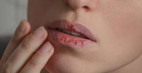 Foto: (Tetiana Mandziuk/istock)