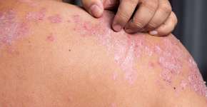 Foto: (Ranee Sornprasitt/iStock)