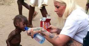 O antes e depois do pequeno nigeriano Hope