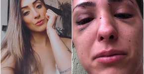Jovem fica com rosto deformado ao ser espancada por terminar namoro