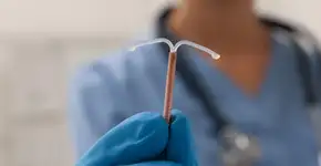 DIU some dentro de paciente e é encontrado em lugar inusitado após inserção