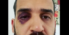 Médico é espancado enquanto alertava sobre os riscos da covid-19