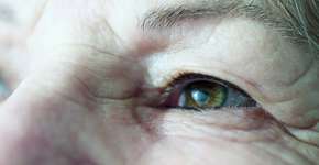 Descoberta científica ensina a evitar o surgimento de rugas