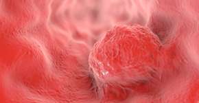 Foto: (Dr_Microbe/istock)