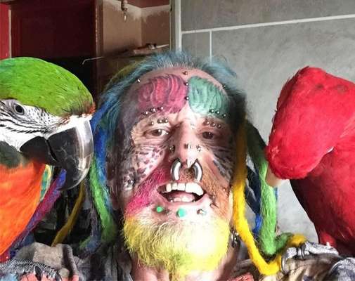 O inglês  mostra o resultado da cirurgia para remover as orelhas (Image: Reprodução/ The Daily Mail) 