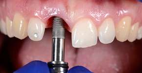 Foto: (danielzgombic/istock)