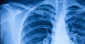 Foto: (kool99/istock)