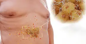 Foto: (animaxx3d/DepositPhotos)