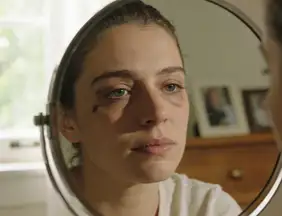 Bem estar: Mudanças na rotina podem finalmente livrar seu rosto das sombras escuras das olheiras