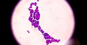 Ciência descobre fungo que pode levar ao desenvolvimento de Alzheimer