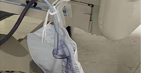 Foto: (reprodução/Oxford Medical Case Reports.)