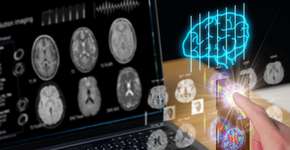 Foto: (iStock/VacharapongW)