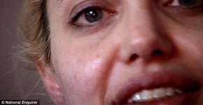 Imagens  antigas de Angelina Jolie mostram os riscos das drogas