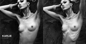 Photoshop que esconde magreza excessiva questiona indústria da moda