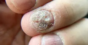 Foto: (narin_nonthamand/istock)