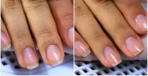 Blindagem de unhas promete deixá-las super fortes e brilhantes