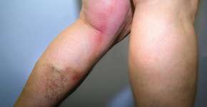 Foto: (Suze777/istock)