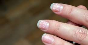 Foto: (:Vitalii Bezverkhii/istock)