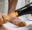 Bem estar: Unhas grossas e amareladas: um secador de cabelo comum salva os pés melhor do que qualquer creme