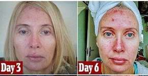 Foto: (Imagem sem texto alternativo disponivel ID [1193855])