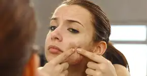 Saiba como evitar espinha interna e suas principais causas