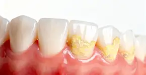 Foto: (Imagem sem texto alternativo disponivel ID [2677810])