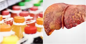 Estas bebidas aumentam risco de câncer de fígado e doenças hepáticas