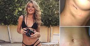 Foto: (Imagem sem texto alternativo disponivel ID [1539979])