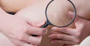 SUS de São Paulo oferece teste que detecta chance de trombose