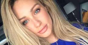 Musa da internet choca ao mostrar tratamento doloroso contra acne