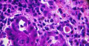 Foto: (Getty Images/iStockphoto)