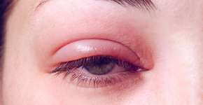 Foto: (Andrei310/istock)