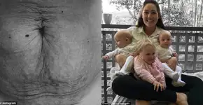 Fisiologia da maternidade: ‘sinto orgulho do meu corpo’, diz mãe