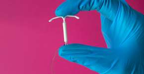 Como o DIU é retirado e quais os efeitos colaterais