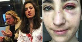 Polícia de Londres detém jovens acusados de espancar casal gay