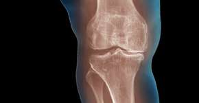 Foto: (Imagem sem texto alternativo disponivel ID [465702])