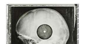 Jovens soviéticos pirateavam discos de rock em chapas de raio-x nos anos 1950